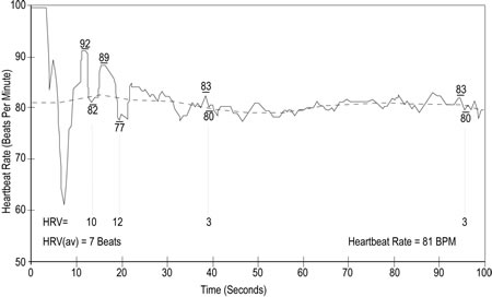 low heart rate variability and coherence indicating health risk