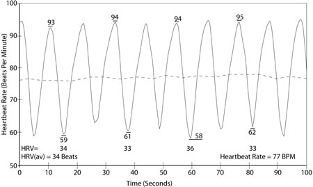 high heart rate variability and coherence