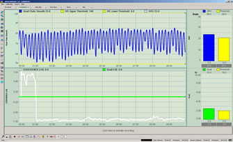 Correlation of Valsalva Wave And Heart Rate During Coherent Breathing