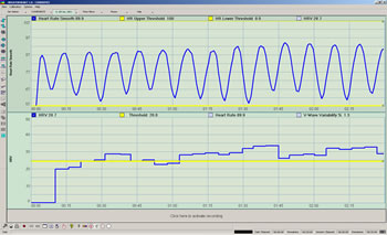 Heart Rate Variability