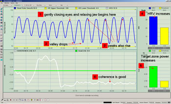 Cultivation of relaxation response and heart rate
