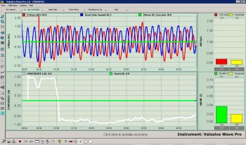 Valsalva Wave And Heart Rate Synchrony And Phase Correlation Captured With Valsalva Wave Pro